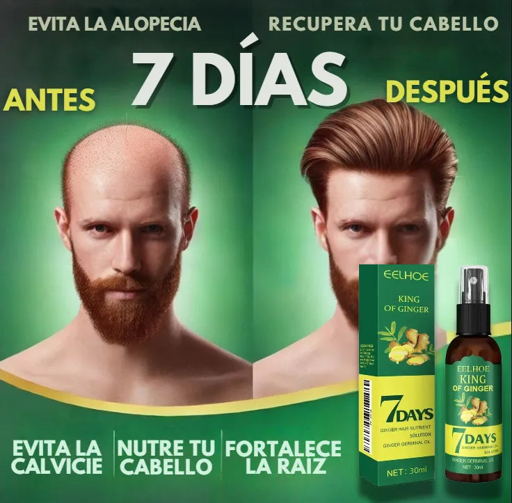 7 días: Tónico para el Crecimiento del Cabello