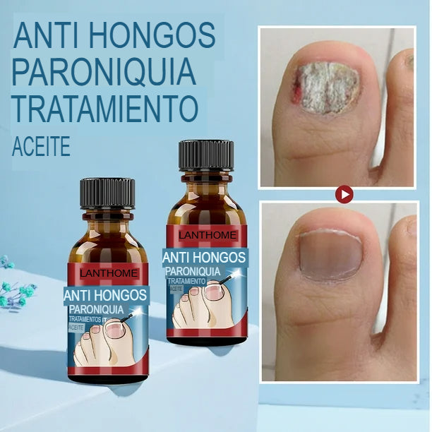 Tratamiento para Hongos - Paga 1 Lleva 2 unidades
